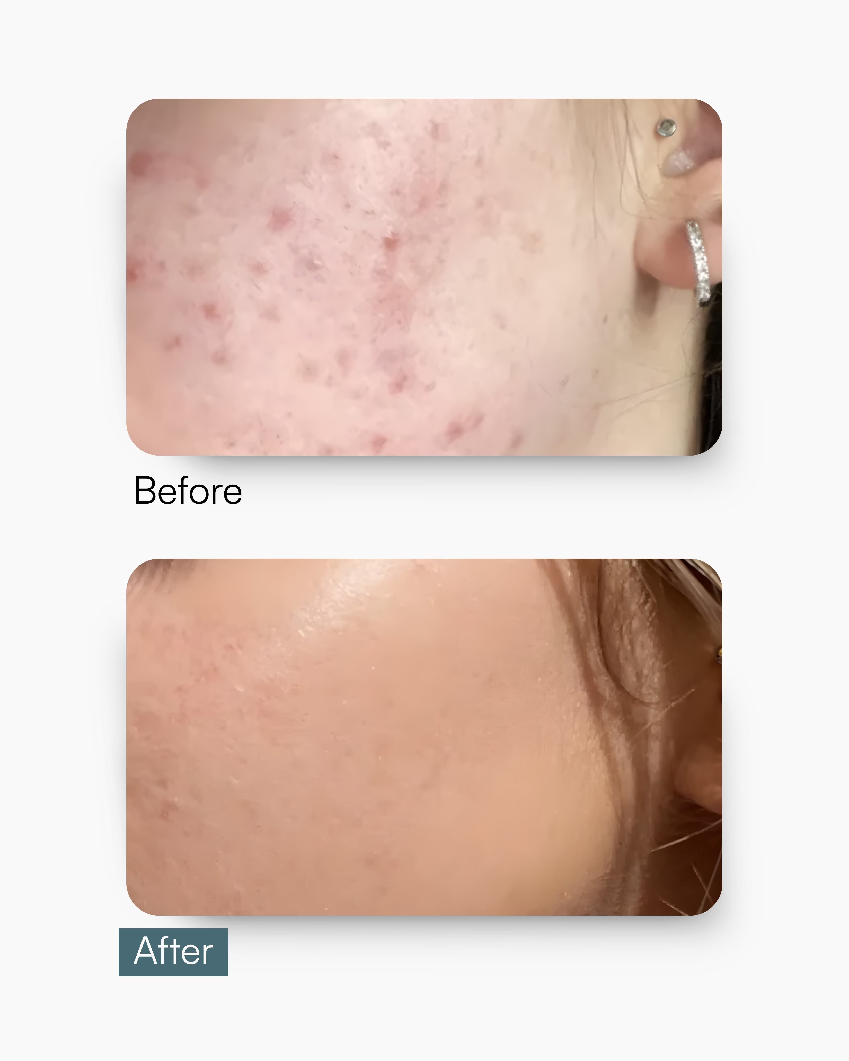 Pore Perfect Serum – Niacinamide Serum