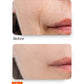 Youth Restore Serum – Anti-Aging Serum