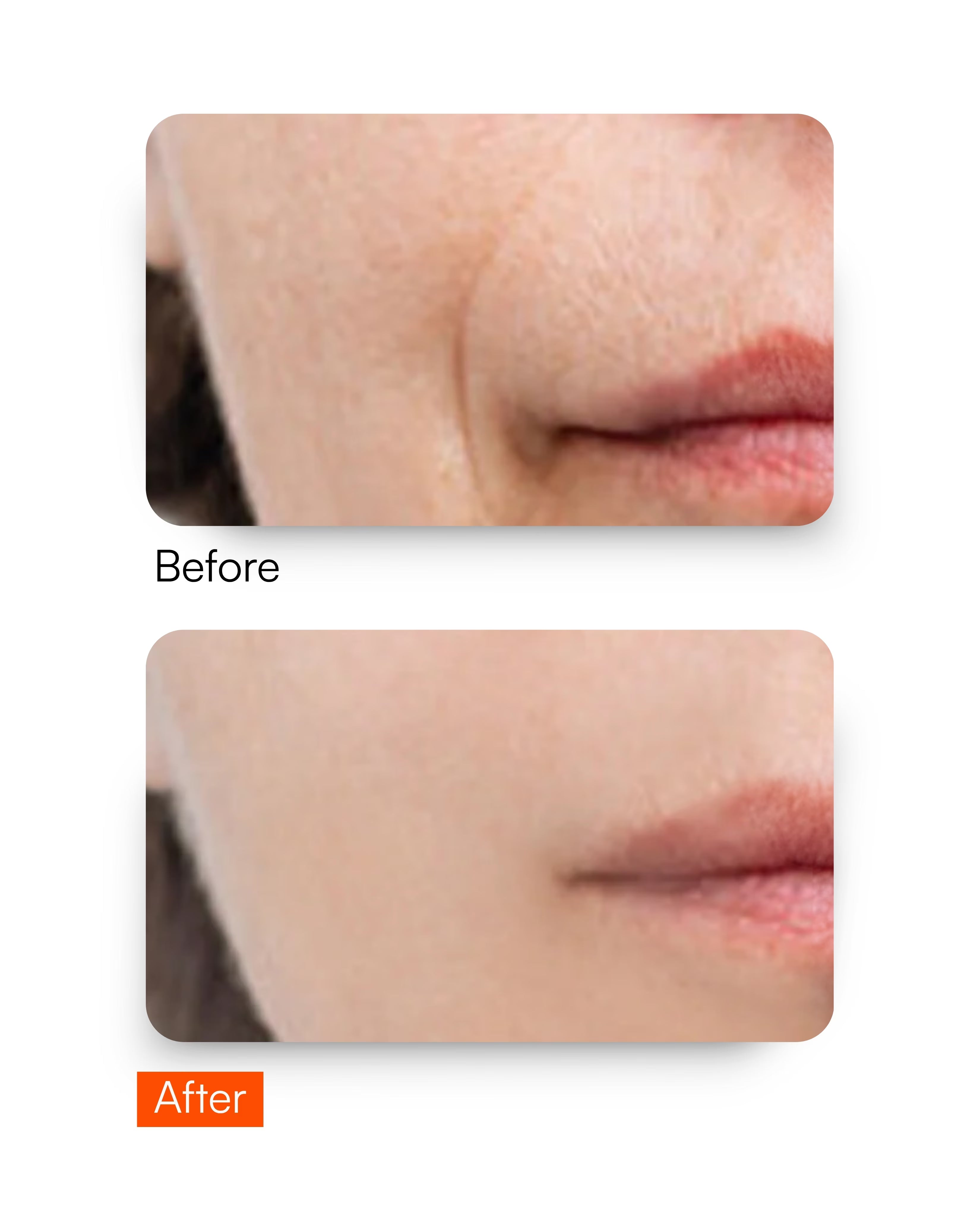 Youth Restore Serum – Anti-Aging Serum