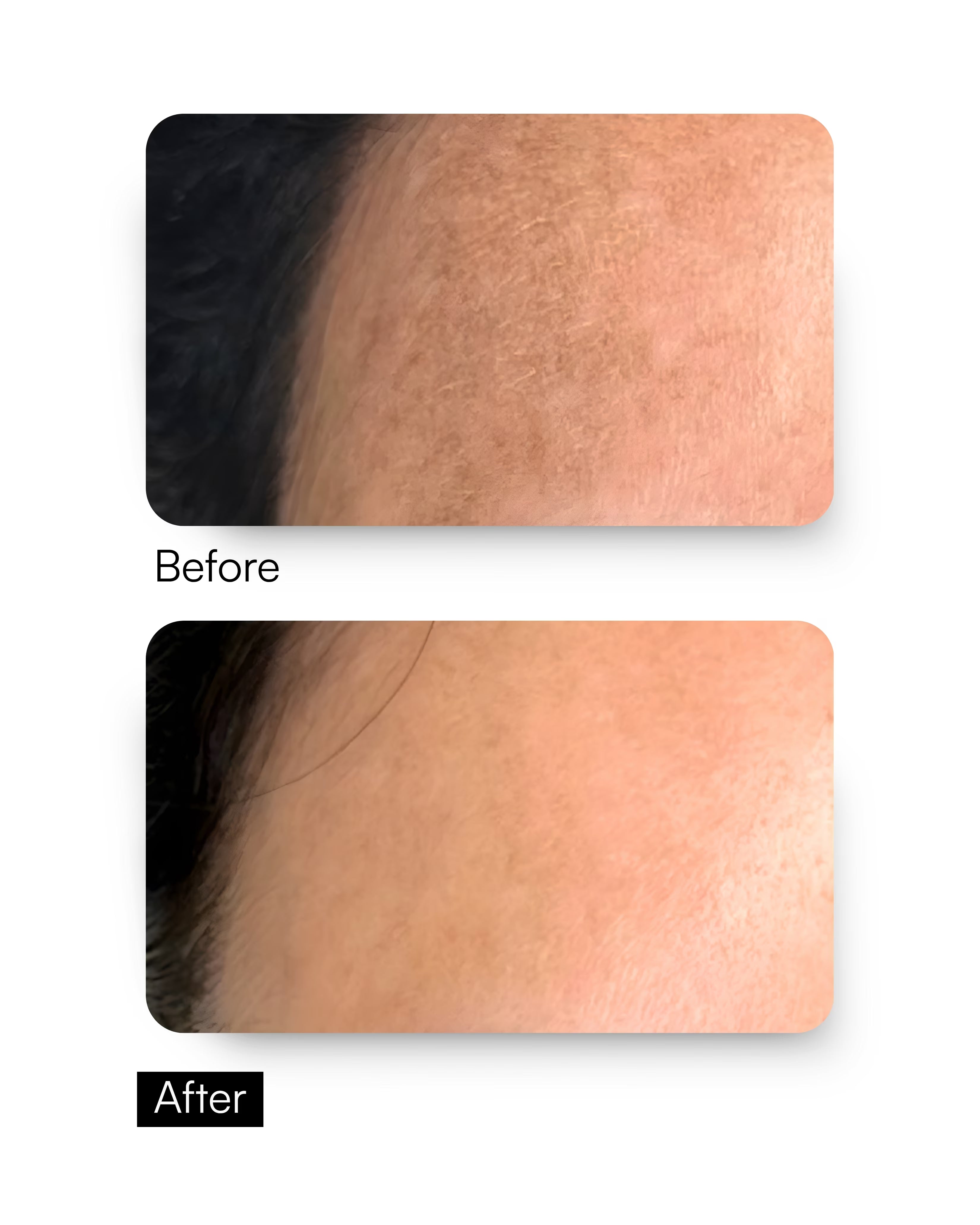 Glow Renew Toner – Glycolic Toner