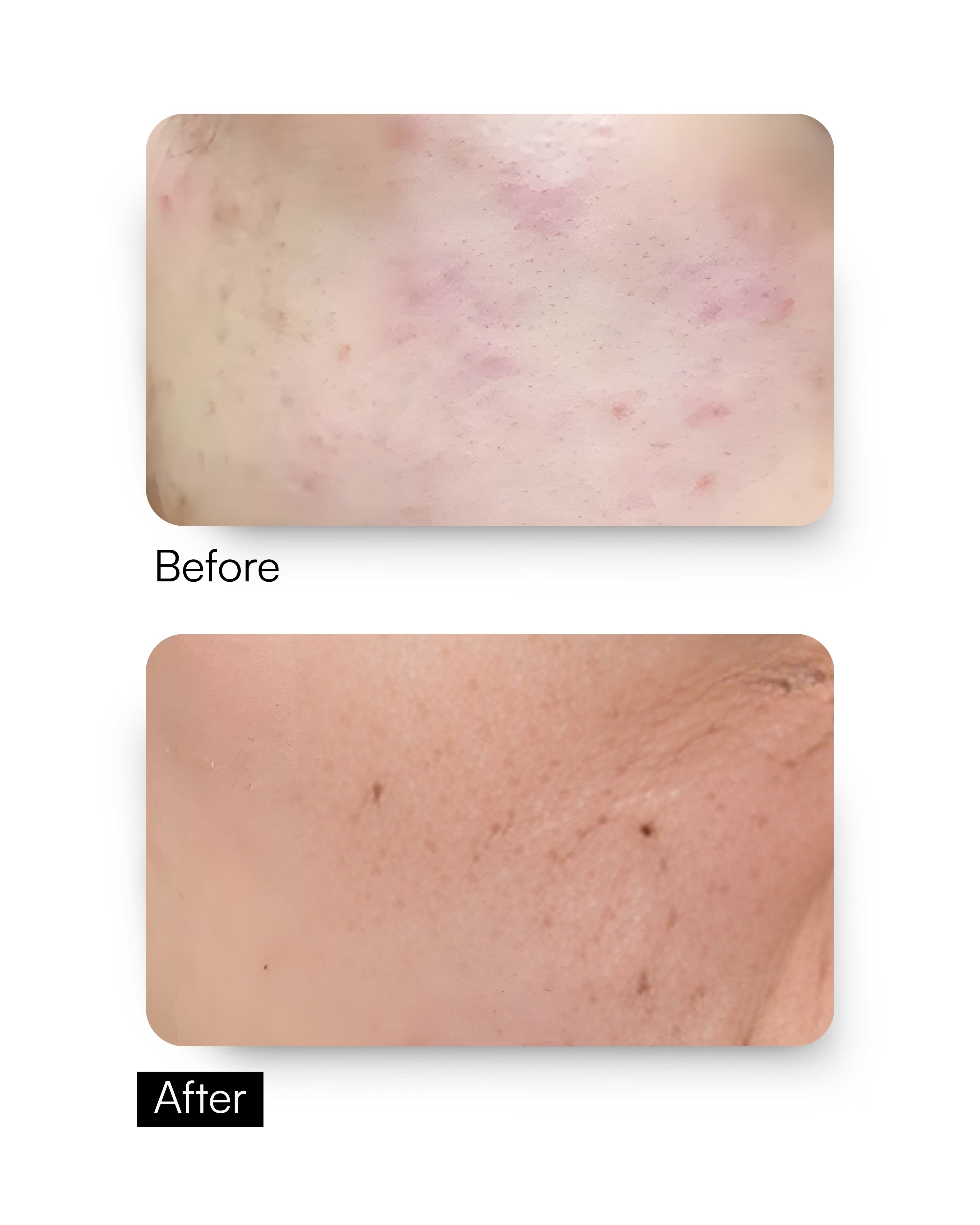 Daily Purifying Wash – Gentle Cleanser