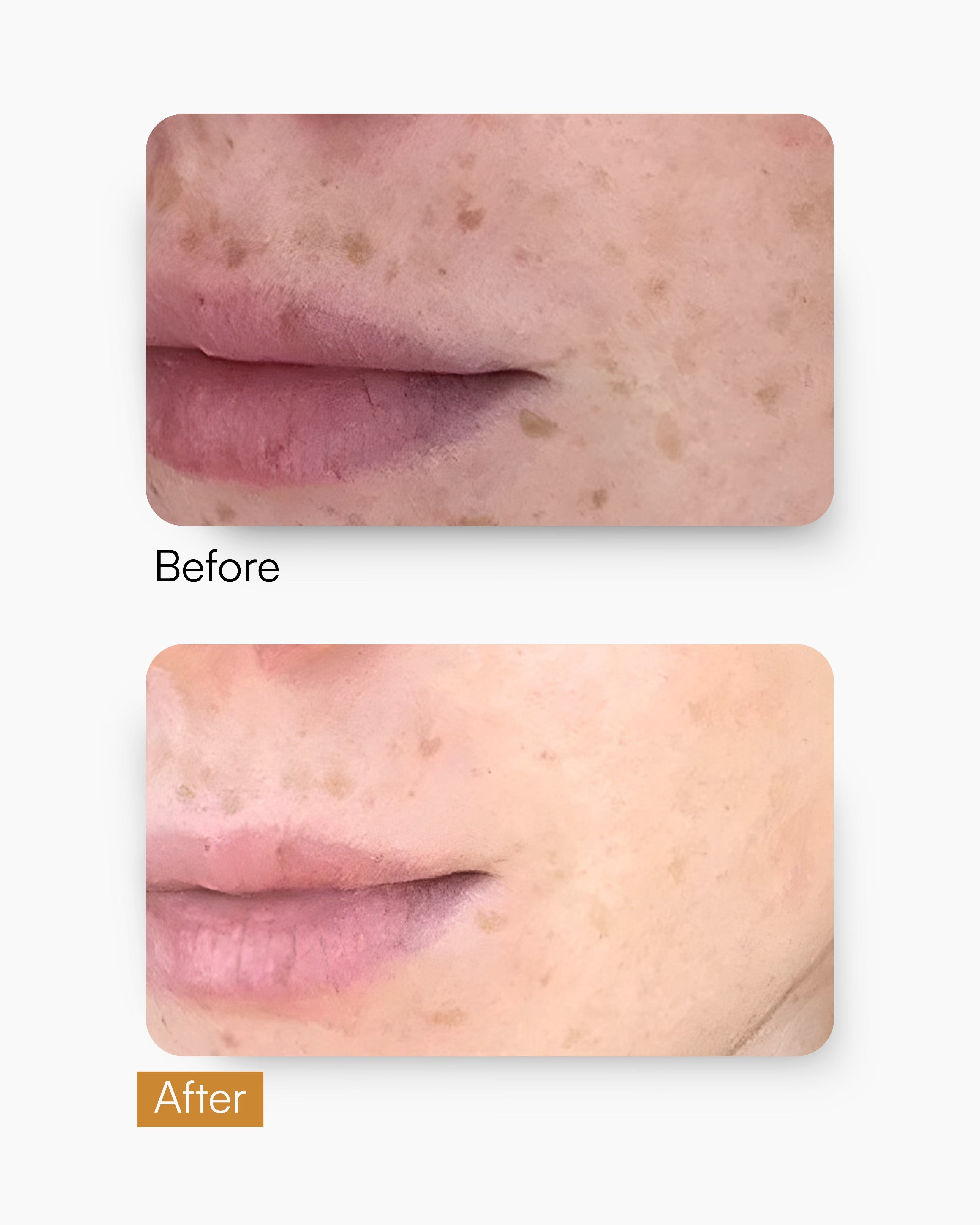 C Bright Booster – Vitamin C Serum